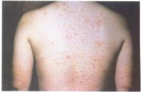 ţƤѢ������Ҫ�˽��һЩ������ʶ