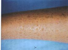 ���������۲�