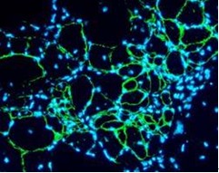 �ҹ�ţƤѢ������ͻ��