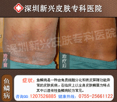 ���۲����ݺ��ӵ��Ŵ�����