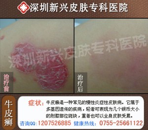 ����ѹ��������ţƤѢ