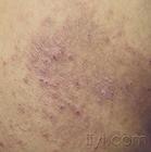 ������Ƥ�׵�Σ����������Щ�أ�