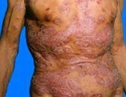 �����м����������