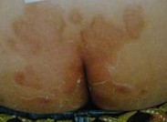 �β�ţƤѢ��м��Ҫ��ϸȷ��