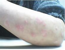 ����ţƤѢ����ǰ��Ԥ��