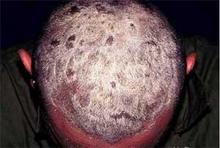 ͷ����м������ϴͷʮ��С��