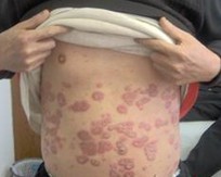 ţƤѢ������η�ֹ���ಡ