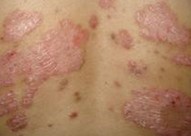 ţƤѢ���ߵ�������ʳ��֪