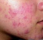 �����̵��ഺ������