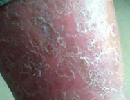 ţƤѢ����Ҫ���䵰����