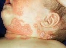 ţƤѢ��ҩ��ȫ