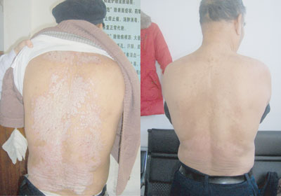 ����ţƤѢҪ������Ǯ