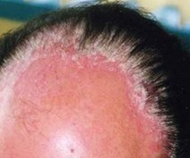 ͷ��ţƤѢ��������