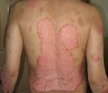 ͳ��ѧ��ţƤѢ���ִ��ڵ�ԭ��