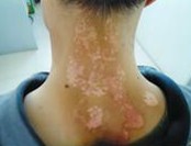 ����ţƤѢר��ҽԺ�����