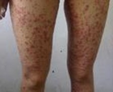 ����ţƤѢ����ҽ��