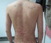 ����ţƤѢ�ļ�ҽԺ����