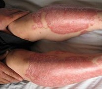 ���ڽϺõ�ţƤѢҽԺ