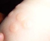 ݡҽԺ