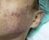 �����ഺ������Ч�ķ�����ʲô