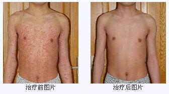 ���۲�����ǰ��Ա�