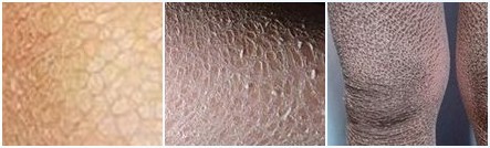 ���۲���֢״����