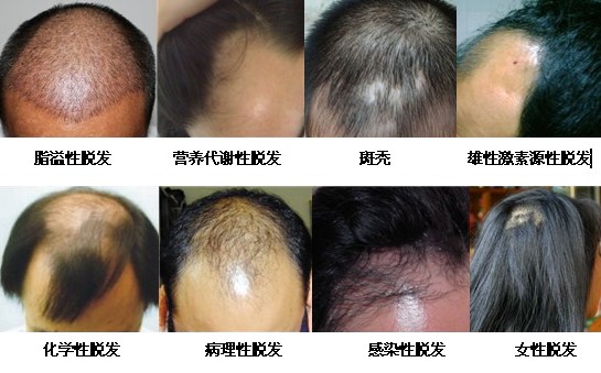 �ѷ��ĳ���֢״����