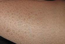 ��������Ƥ����ר��ҽԺ