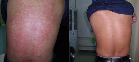 ݡ���������ǰ��ĶԱ�ͼ