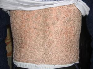 ���ϵ�Ƥ������Ƥ��ô����